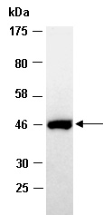 KRT18 Antibody Western (Abiocode)