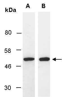 PAX2 Antibody Western (Abiocode)