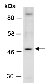 PAX6 Antibody Western (Abiocode)