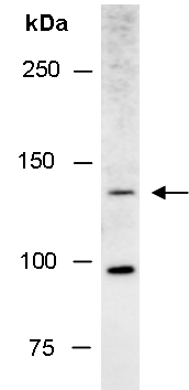 TSC1 Antibody Western (Abiocode)