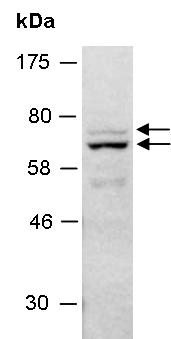 MMP17 Antibody Western (Abiocode)