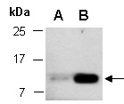 NGF Antibody Western (Abiocode)