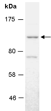 KDM7 Antibody Western (Abiocode)