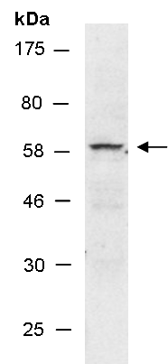 CHEK1 Antibody Western (Abiocode)
