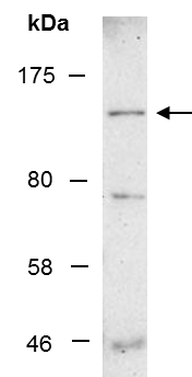 ATP11A Antibody Western (Abiocode)