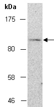 MSH2 Antibody Western (Abiocode)