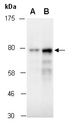 PRKCA Antibody Western (Abiocode)