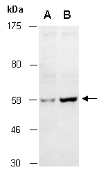 MDM2 Antibody Western (Abiocode)