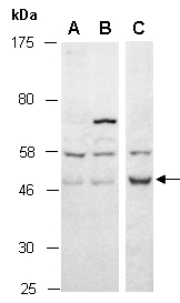 CYTIP Antibody Western (Abiocode)