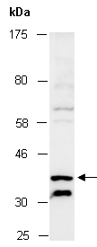 CYTIP Antibody Western (Abiocode)