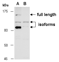 KDM2A Antibody Western (Abiocode)