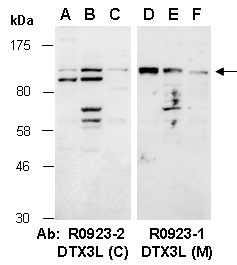 DTX3L Antibody Western (Abiocode)