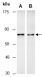 DEF6 Antibody Western (Abiocode)