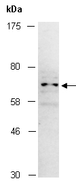 MMP15 Antibody Western (Abiocode)