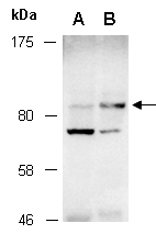 STAT5B Antibody Western (Abiocode)