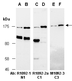 TET3 Antibody Western (Abiocode)