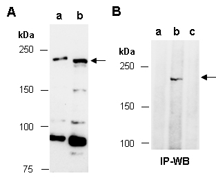TET1 Antibody Western (Abiocode)