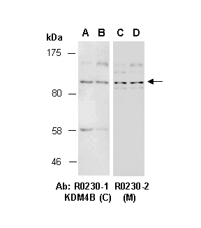 KDM4B Antibody Western (Abiocode)