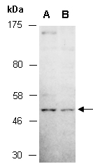 SHC1 Antibody Western (Abiocode)