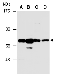 PAK2 Antibody Western (Abiocode)
