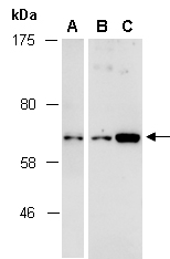 PAK1 Antibody Western (Abiocode)