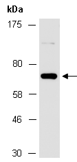 FANCC Antibody Western (Abiocode)