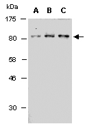 TLK1 Antibody Western (Abiocode)