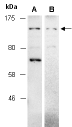 NRIP1 Antibody Western (Abiocode)
