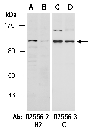 MLXIPL Antibody Western (Abiocode)