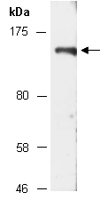 KDM4B Antibody Western (Abiocode)
