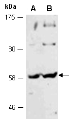 CD14 Antibody Western (Abiocode)