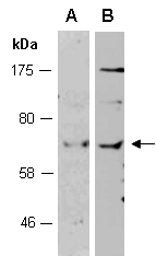 FGL2 Antibody Western (Abiocode)
