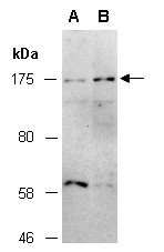 TRIM33 Antibody Western (Abiocode)