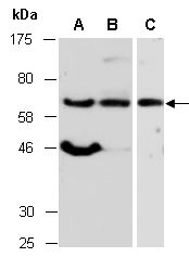 MBD4 Antibody Western (Abiocode)