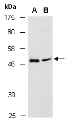CCR7 Antibody Western (Abiocode)