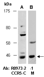 CCR5 Antibody Western (Abiocode)