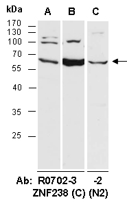 ZNF238 Antibody Western (Abiocode)