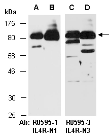 IL4R Antibody Western (Abiocode)