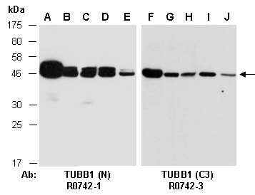 TUBB1 Antibody Western (Abiocode)