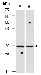 CTSK1 Antibody Western (Abiocode)