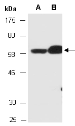 KRT5 Antibody Western (Abiocode)