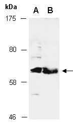 KDM4D Antibody Western (Abiocode)