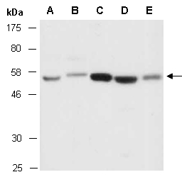 CCR3 Antibody Western (Abiocode)