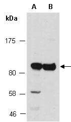 TRIM37 Antibody Western (Abiocode)