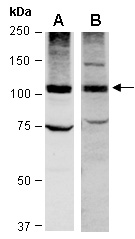 RB1 Antibody Western (Abiocode)