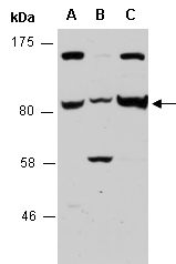 ITGB2 Antibody Western (Abiocode)