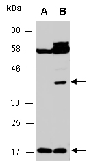 VEGFA Antibody Western (Abiocode)