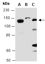 ITGA2B Antibody Western (Abiocode)