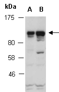 STAT2 Antibody Western (Abiocode)