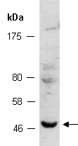 PAX8 Antibody Western (Abiocode)